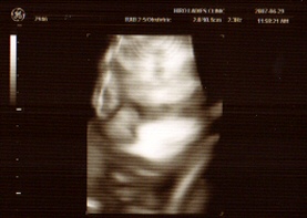 A clear picture of Rikuto, with his Dad's nose!